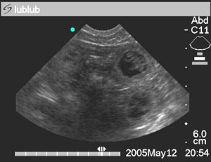 Ultrasound - Click to view the larger version